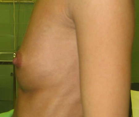 6. eset, műtét előtt