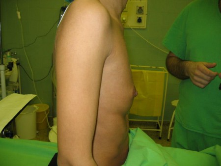 6. eset, műtét előtt