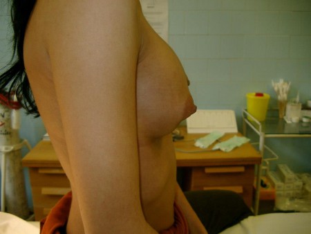  6. eset, műtét után.